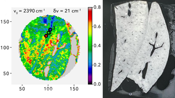 Zweiteilige Abbildung einer Gewebeprobe aus einer Rattenleber. Links zeigt eine farbkodierte Karte der Lichttransmission im mittleren Infrarot bei 2390 cm⁻¹ (4180 nm). Die runde Gewebeprobe erscheint überwiegend grün bis gelb, mit zentral gelegenen, inselartigen Bereichen erhöhter Transmission sowie vereinzelten stark absorbierenden Zonen, insbesondere am Rand. Drei markierte Punkte kennzeichnen ausgewählte Messpositionen. Eine Farbskala rechts neben der Karte zeigt Transmissionswerte von 0 bis 0,8. Rechts ist zum Vergleich ein konventionelles Foto desselben Organschnitts mit sichtbaren Gefäßstrukturen dargestellt.
